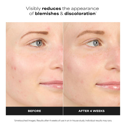 Paula's Choice BOOST 10% Azelaic Acid Booster Cream Gel Face Serum with Salicylic Acid, Oil-Free Skin Brightening Serum for Face, Fragrance-Free