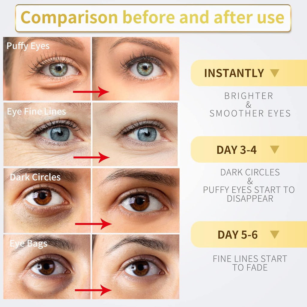 24K gold under eye patches for dark circles, puffiness, and wrinkles care, 60pcs